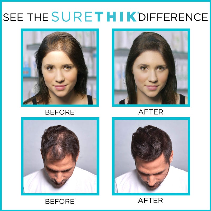 SURETHIK Hair Thickening Fibers (Pack of 4 x 30g Bottle, Black), For Thicker Looking Hair, Building Hair Fibers to Conceal Thinning Hair for Men & Women - Image 4